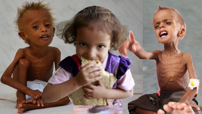 خطير جداً: الأمم المتحدة: تحذر من ارتفاع عدد الجائعين في اليمن إلى 20 مليون