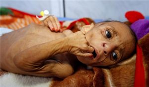 Iran Slammed Us, Britain, France for Massacre of Yemeni Women, Children