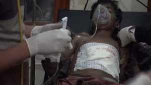 A Child Killed by Saudi Gunfire in Saada