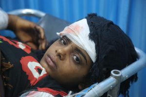 What the attack on Hodeidah means for Yemen’s children: 8 things you need to know