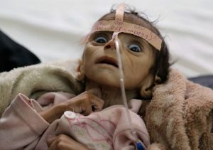 In Yemen, a child dies every 10 minutes: UNICEF