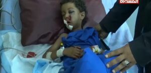 Saudi-Affiliated Snipers Result in Child Casualties in Taiz