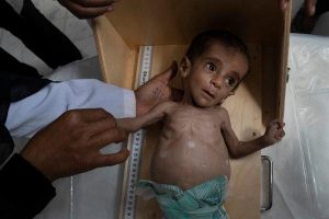 The Children of Yemen Are in Deep Need of Help