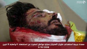 Breaking: Fresh Saudi Crimes Kill and Injure 20 Civilians in Yemen (Photos)