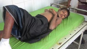 Three Children Seriously Injured in Hodeidah by Saudi Cluster Bombs Remnants: Photos