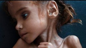 Corruption of International Aid Organizations, in Yemen, Worsen Humanitarian Situation
