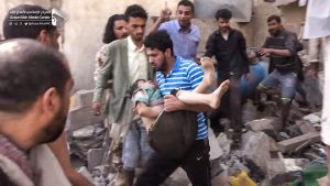 وزارة الصناعة والتجارة ِ تدين بشدِّة  جريمةِ العدون الاجرامية التي استهدفت منازلَ المدنيينَ في صنعاء
