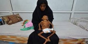 ارقام مفزعة حول معاناة أطفال اليمن
