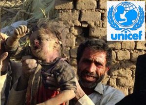 اليونيسيف: الحرب في اليمن قتلت وأصابت 61 طفلاً خلال شهر