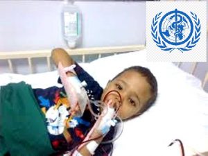 الصحة العاليمة : علاج مرضى الثلاسيميا بات معجزة في اليمن