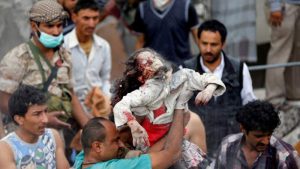 أطفال اليمن الأكثر عرضة للقتل بسبب العدوان المستمـر على البلاد