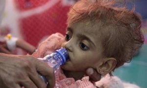 وكالة إيطالية: عدد مرعب لوفيات الأطفال في اليمن