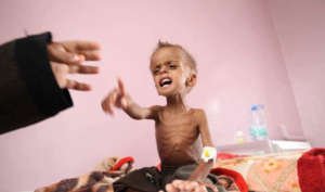 منظمة دولية: إستمرار العدوان والحصار يدفع اليمن إلى تصدر قائمة الجوعى